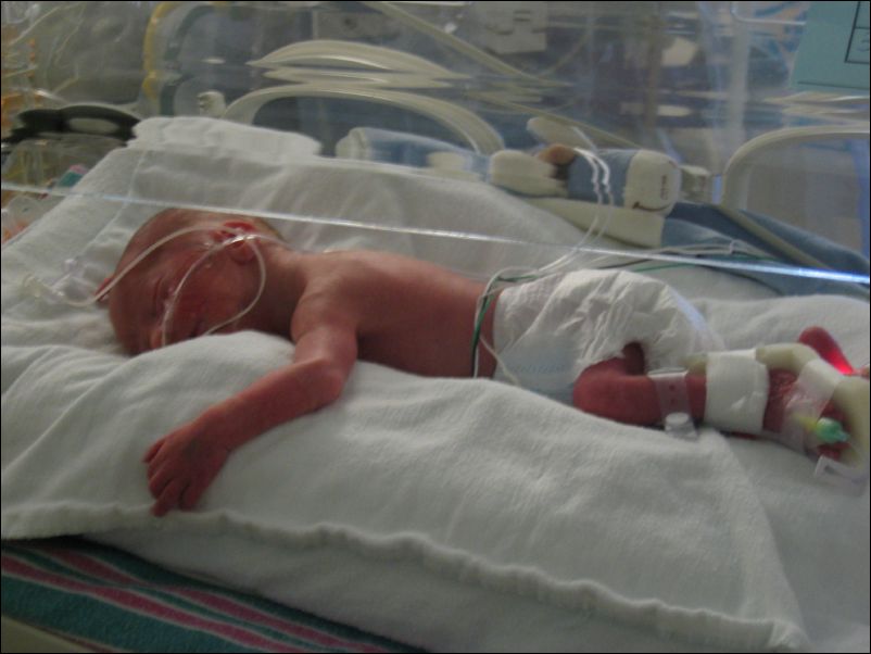 Owen Sleeping, fewer tubes